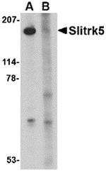 SLITRK5 Antibody in Western Blot (WB)