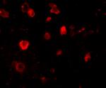 SLITRK4 Antibody in Immunohistochemistry (IHC)