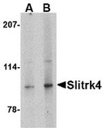 SLITRK4 Antibody in Western Blot (WB)