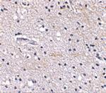 FBXL20 Polyclonal Antibody