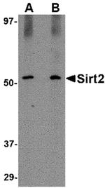 SIRT2 Antibody in Western Blot (WB)