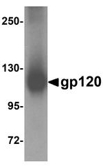 HIV1 gp120 Polyclonal Antibody