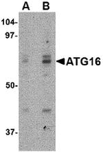 ATG16L1 Antibody in Western Blot (WB)