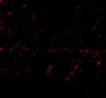 LGI1 Polyclonal Antibody