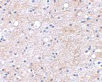 LGI1 Antibody in Immunohistochemistry (IHC)