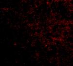 LGI2 Polyclonal Antibody