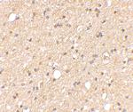 LGI2 Antibody in Immunohistochemistry (IHC)