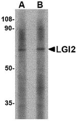 LGI2 Antibody in Western Blot (WB)