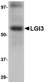 LGI3 Polyclonal Antibody