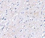 BAP3 Polyclonal Antibody