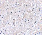 BAP3 Polyclonal Antibody