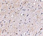 NIPSNAP1 Antibody in Immunohistochemistry (IHC)