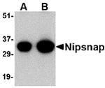 NIPSNAP1 Antibody in Western Blot (WB)