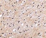 NIPSNAP1 Polyclonal Antibody