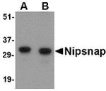 NIPSNAP1 Antibody in Western Blot (WB)