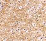 AIFM3 Polyclonal Antibody