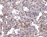 TMC6 Polyclonal Antibody