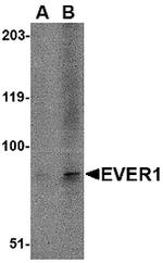 TMC6 Antibody in Western Blot (WB)