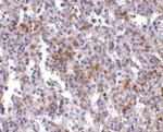 TMC6 Antibody in Immunohistochemistry (IHC)
