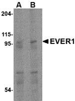 TMC6 Antibody in Western Blot (WB)