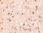 IRGM Polyclonal Antibody