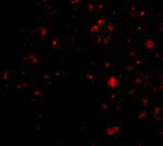 AMBRA1 Polyclonal Antibody