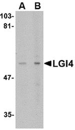 LGI4 Polyclonal Antibody