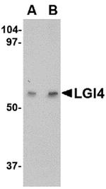 LGI4 Polyclonal Antibody