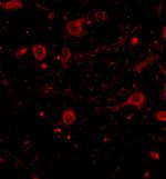 CAPS1 Antibody in Immunohistochemistry (IHC)