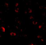 CAPS1 Polyclonal Antibody