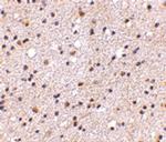 CAPS1 Antibody in Immunohistochemistry (IHC)