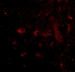 CADPS2 Polyclonal Antibody