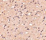 ELOVL6 Polyclonal Antibody