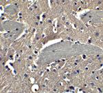 NPTX2 Polyclonal Antibody