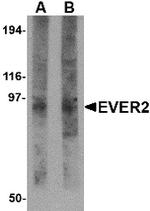 EVER2 Polyclonal Antibody