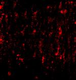 SATB2 Polyclonal Antibody