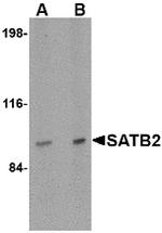 SATB2 Antibody in Western Blot (WB)