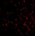 SATB2 Polyclonal Antibody