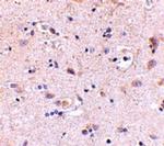 SATB2 Antibody in Immunohistochemistry (IHC)