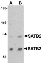 SATB2 Antibody in Western Blot (WB)