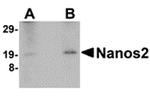 NANOS2 Polyclonal Antibody