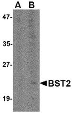 BST-2 Polyclonal Antibody