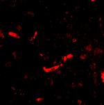 SAPAP2 Polyclonal Antibody