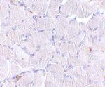 LIMP2 Polyclonal Antibody