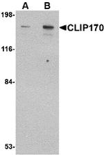 CLIP1 Antibody in Western Blot (WB)