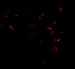 VPS53 Polyclonal Antibody