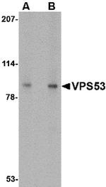 VPS53 Antibody in Western Blot (WB)