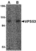 VPS53 Polyclonal Antibody
