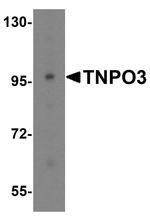 TNPO3 Antibody in Western Blot (WB)