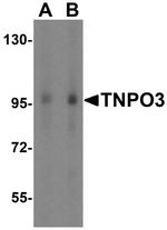 TNPO3 Polyclonal Antibody